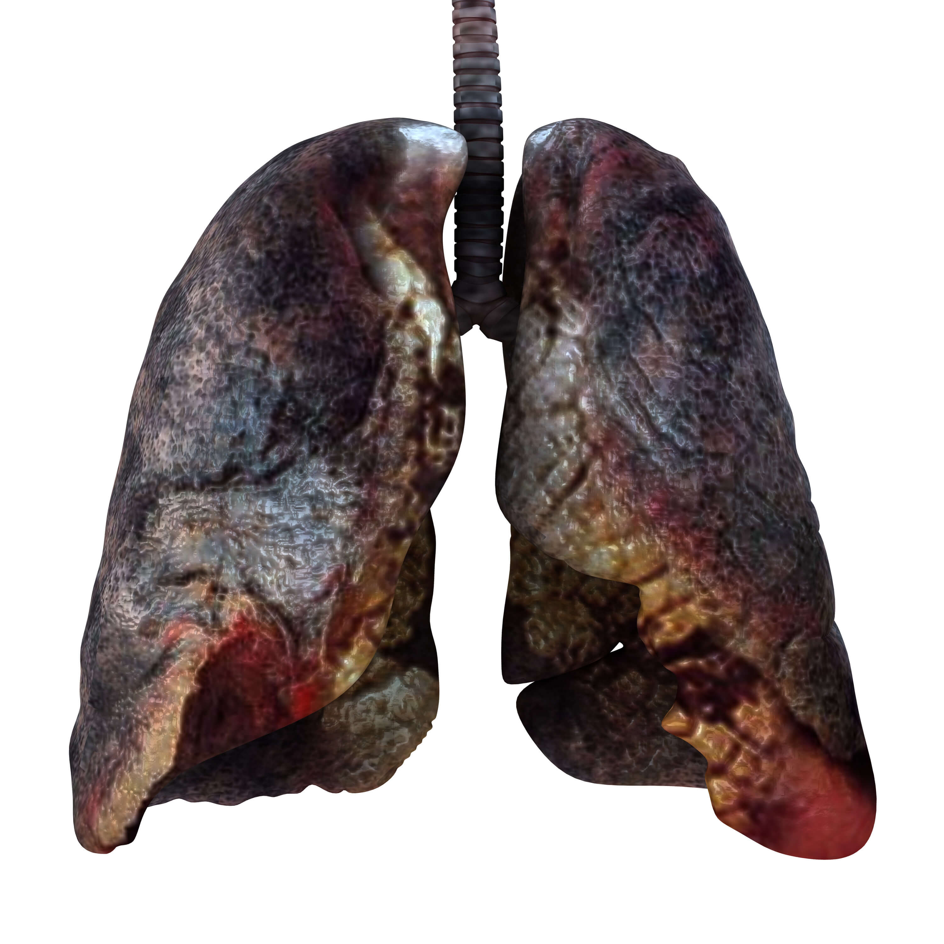 Rak płuca - Rakoobrona